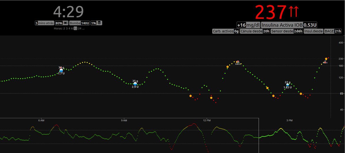 gneuman's tweet image. Primer día de campamento de Ari con la escuela.

2 momentos de baja y 2 de alta.

#WeAreNotWaiting