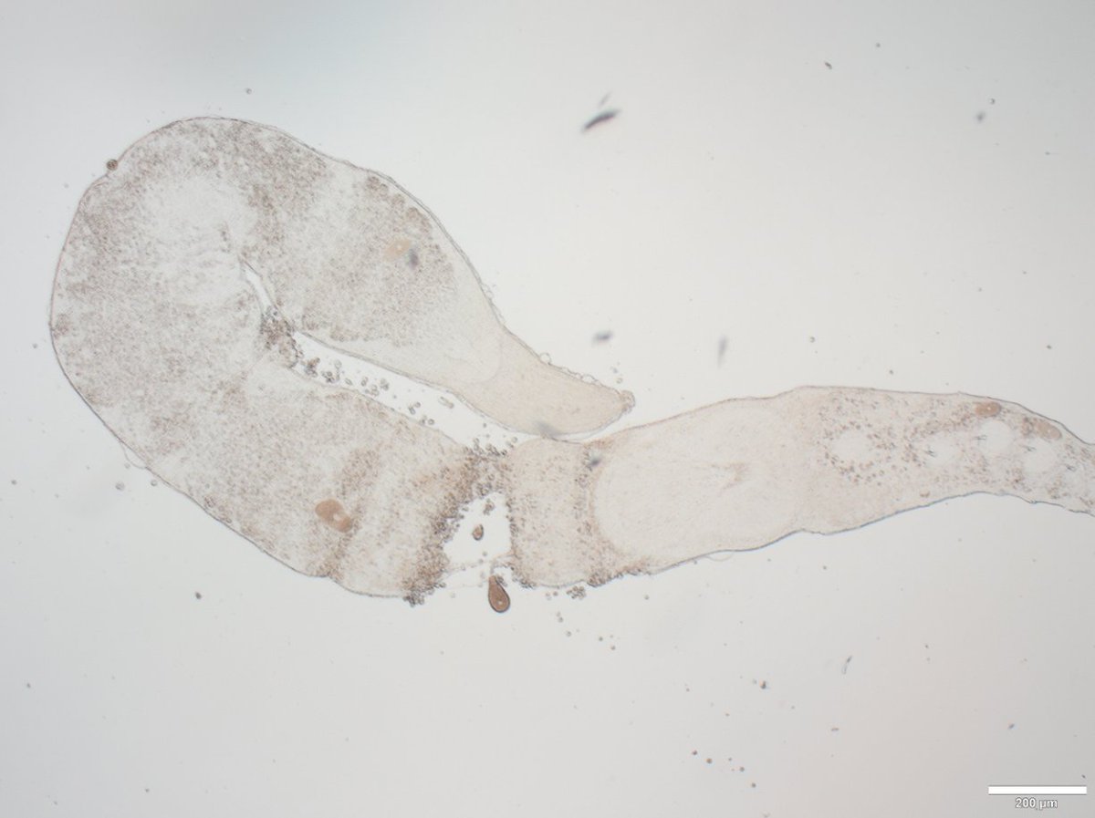 RCManglicm's tweet photo. Unguiphora with apicomplexans. I see 5, what about you? @kmkocot @nvsteenkiste  #meiofauna https://t.co/hmGMbT19Gh