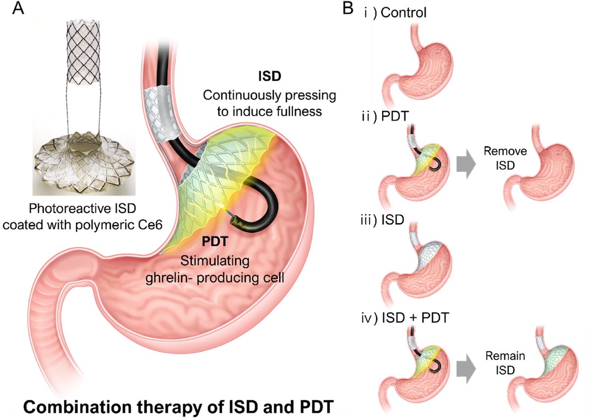 Biomaterials on Twitter ""Obesity therapeutic strategy" Photoactive