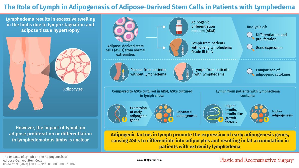 This new <a href="/prsjournal/">Plastic and Reconstructive Surgery</a> study explores how #lymphaticfluid promotes #stemcell transformation into #fatcells in patients with #lymphedema: bit.ly/ImpactsofLymph