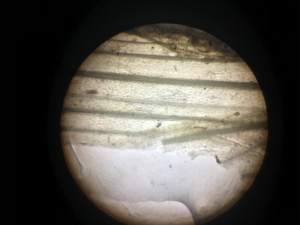HyperTheProot on Twitter "Took these from a microscope. The first 2
