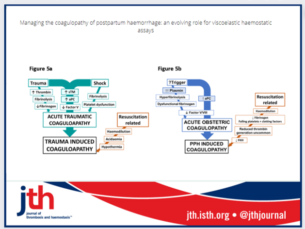 JTHjournal's tweet photo. In 🤰women #bleeding after childbirth; viscoelastic haemostatic assays can identify: 
-normal clotting,
-acute obstetric coagulopathy, 
https://t.co/WRbgw2yckB https://t.co/uDobLtGbxe