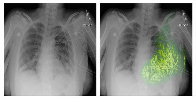 Warum eine KI dieses Röntgenbild als Lungenentzündung klassifiziert hat? Die Antwort ist grellgrün. ❇️ Worum es bei #XAI (explainable AI) geht und wieso sie so wichtig ist, erklärt GI-Vorstandsmitglied @scientist_katha in unserem Mitgliedermagazin: inf.gi.de/01/es-dreht-si…