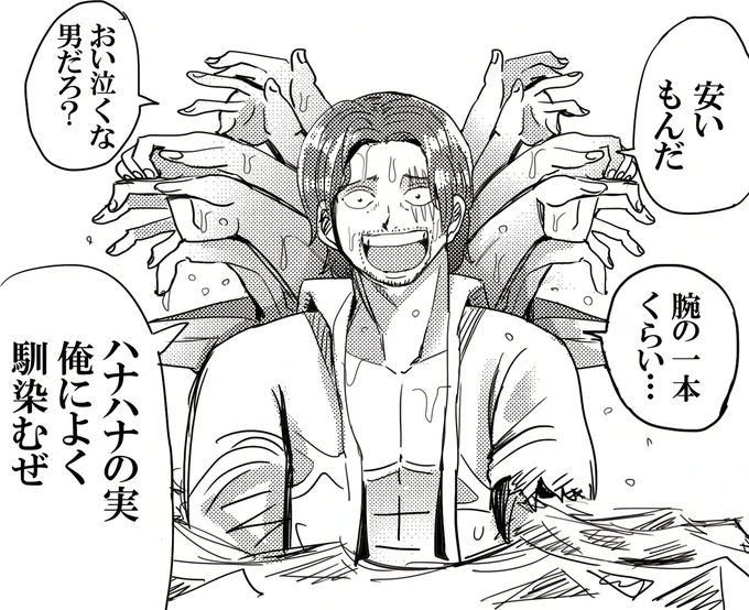 マジで腕が安いシャンクス 