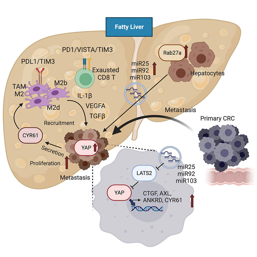 Why fatty liver favors hepatic METASTASES ? This brilliant study by @SekiEki proves that extracellular vesicles in fatty liver promote a metastatic tumor microenvironment. bit.ly/3WeXesr #livertwitter #MedTwitter