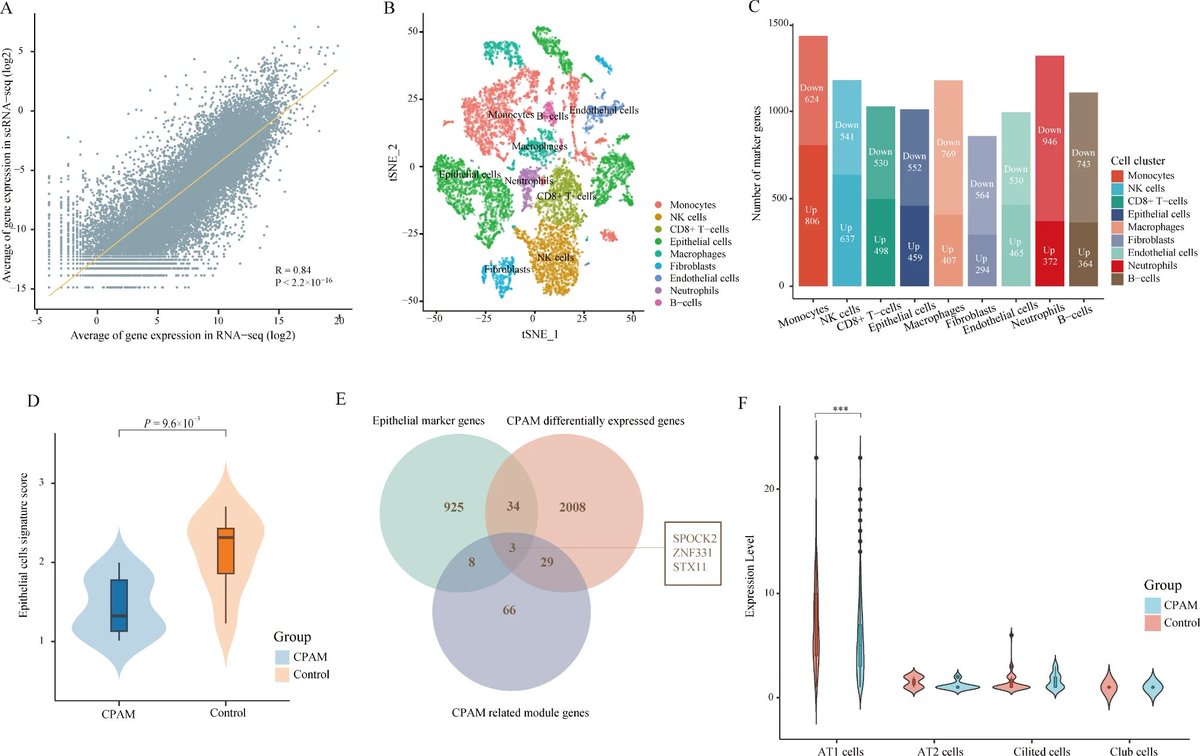 BiomageLtd's tweet photo. Researchers integrate #scRNAseq and #bulkRNAseq data to identify marker genes of congenital pulmonary airway malformation.
https://t.co/7lwASYx4av
SPOCK2 could be a potential diagnostic biomarker gene, and STX11 and ZNF331 could serve as prognostic markers.
#singlecell https://t.co/9AsMMKLEs7