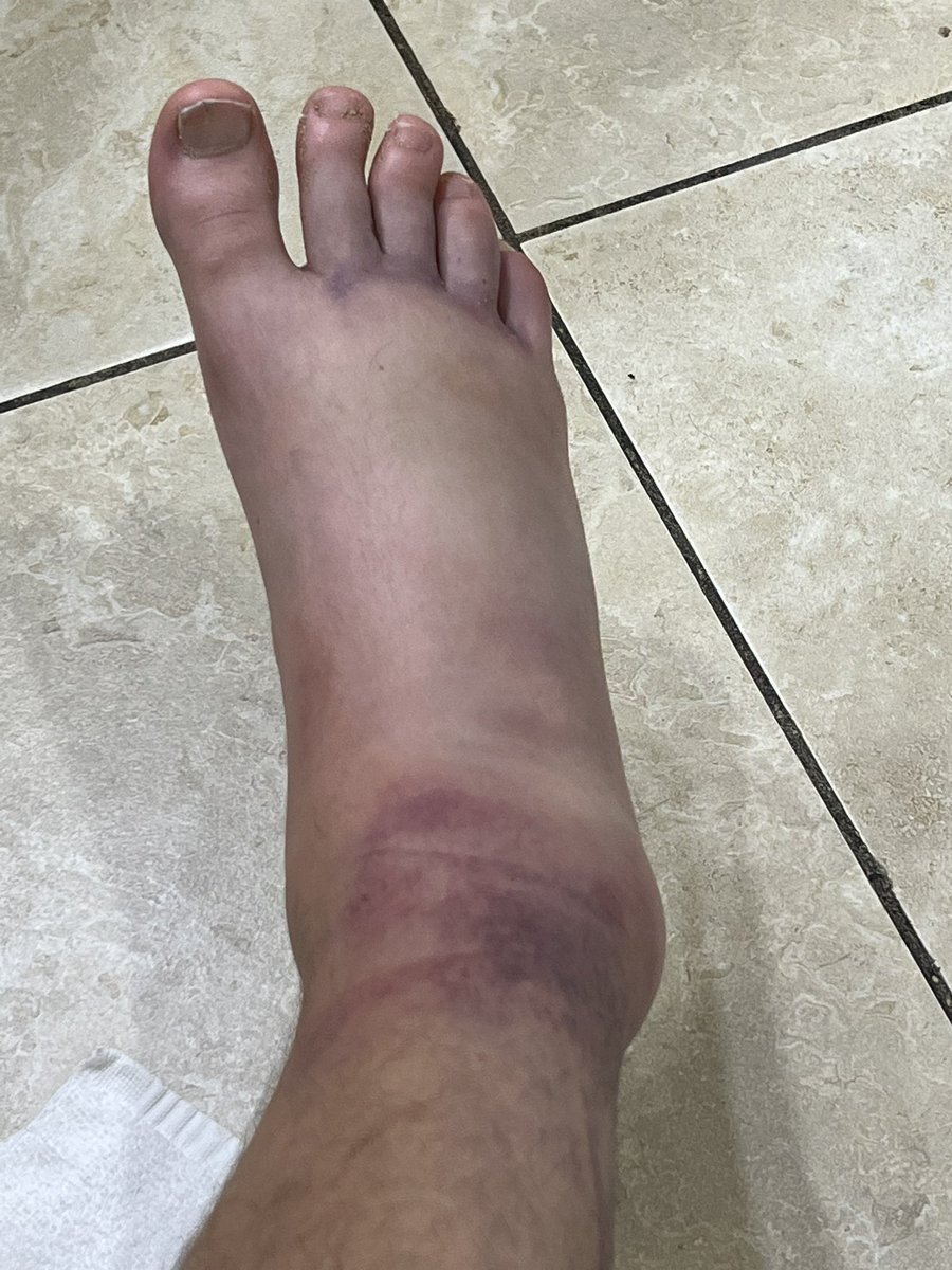 lewis R-F tweet media