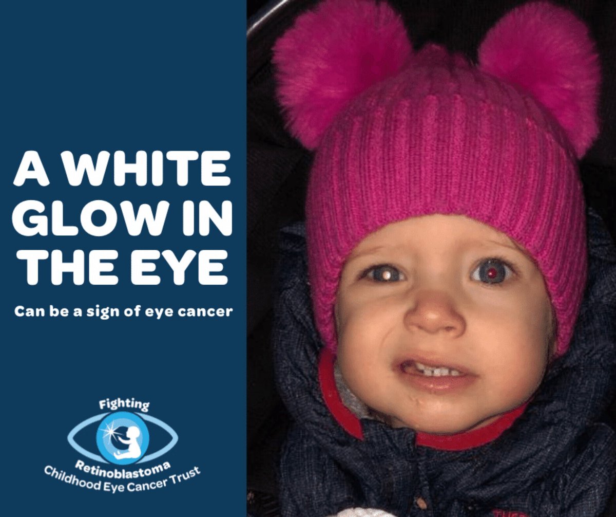 If you see a white glow in the eye, a white pupil or white reflection in a photo where a flash has been used, or when your child is in artificial light or a darkish room, visit a healthcare professional 
#RbWeek #SightCareLocal
