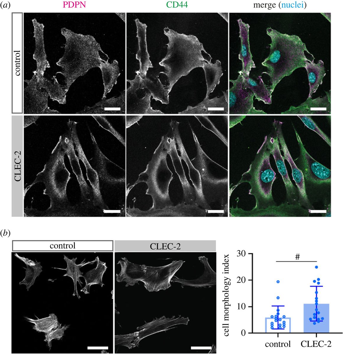 RT <a href="/LMCB_UCL/">UCL Laboratory for Molecular Cell Biology</a>: A collaboration between <a href="/ActonLab/">Dr Sophie Acton</a> and <a href="/ssimoncelli/">Sabrina Simoncelli</a> lab sheds light on PDPN and CD44 action in FRCs using DNA-PAINT ow.ly/KW0R50OoKEC #OpenBiology