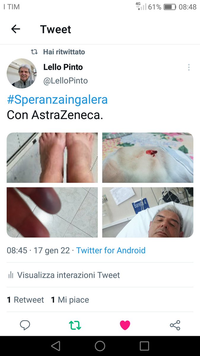 Raffael09417931's tweet photo. #Covid
Bastardi!
Così mi avete ridotto. 
Terminato con l'infarto e tanti altri danni irreversibili. 
Persino il mio DNA è mutato. 
Vigliacchi ASSASSINI. https://t.co/cEPAOOVv0D