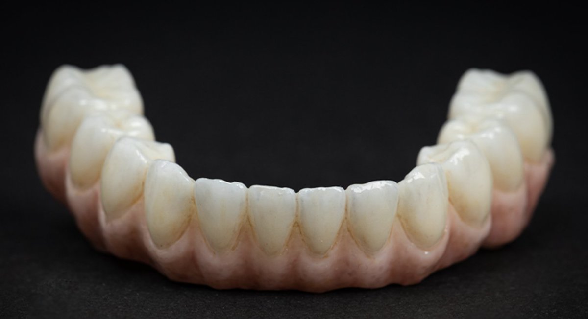 If you are interested in dental treatments or considering getting a Zirconium Crowns, be sure to read this!
#dentaltreatments #zirconiumcrowns #oralhealthtips #precisionmanagement
cliniqueplus.com/blog/how-long-…