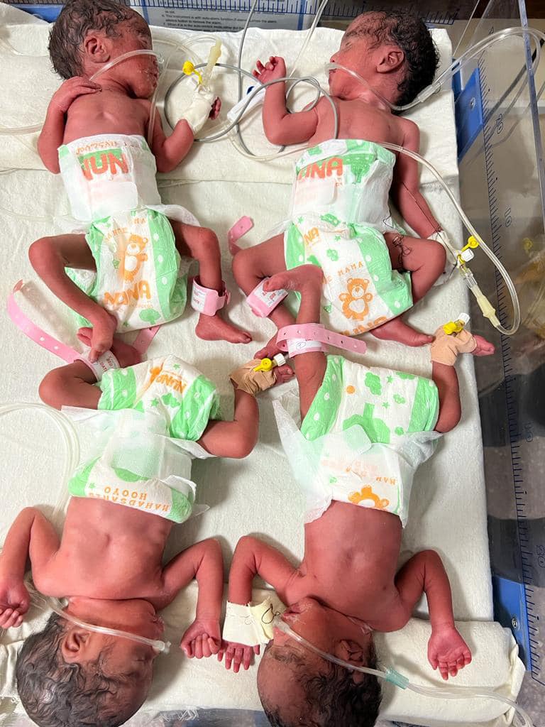 SONNALIVE's tweet photo. In #Mogadishu, a Somali woman named 𝐅𝐚𝐫𝐡𝐢𝐲𝐚 𝐇𝐮𝐬𝐬𝐞𝐢𝐧 𝐀𝐥𝐢 gave birth to quadruplets at #Benadir Hospital. The hospital reports that the mother and her four baby girls are in good health. Doctors say the delivery was without complications. #Somalia #quadruplets https://t.co/YPlrmXp2fj