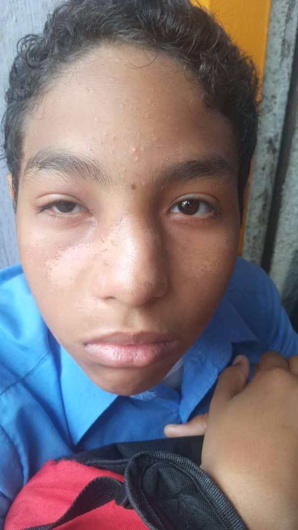 InforTvenezuela's tweet photo. Jovencito con condición autista e hijo del periodista y locutor Ernesto Martinez @ErnestoM1059 ,fue víctima de bullying y de una golpiza en el liceo "Creacion" de Ocumare ,edo Miranda.
El locutor denuncia que fueron estudiantes de 4to y 5to año de bachillerato.
@Tarekwilliamsaab https://t.co/abSHc0Kdex