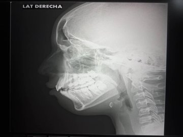 InforTvenezuela's tweet photo. Jovencito con condición autista e hijo del periodista y locutor Ernesto Martinez @ErnestoM1059 ,fue víctima de bullying y de una golpiza en el liceo "Creacion" de Ocumare ,edo Miranda.
El locutor denuncia que fueron estudiantes de 4to y 5to año de bachillerato.
@Tarekwilliamsaab https://t.co/abSHc0Kdex