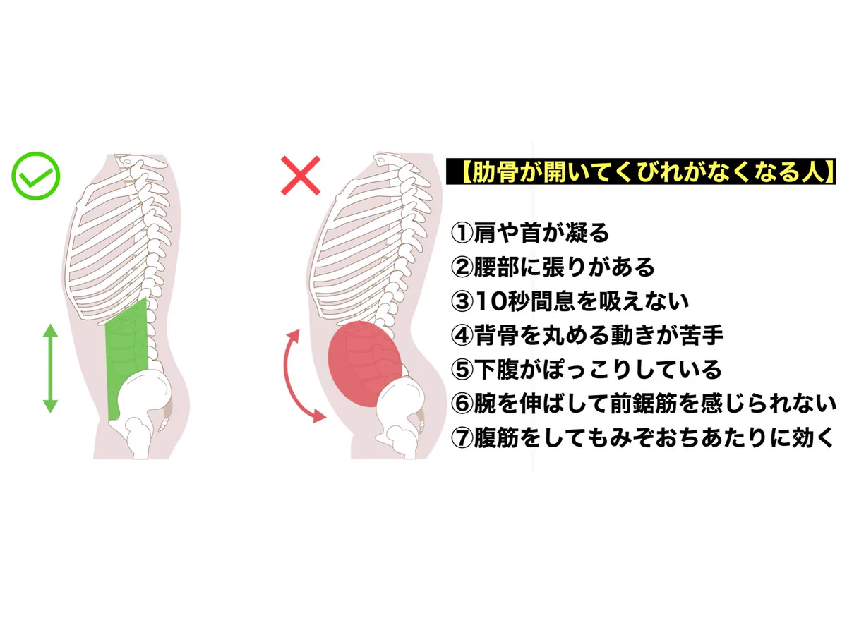 くびれがない寸胴体型！腰が過剰に反っていることが原因かもしれない！