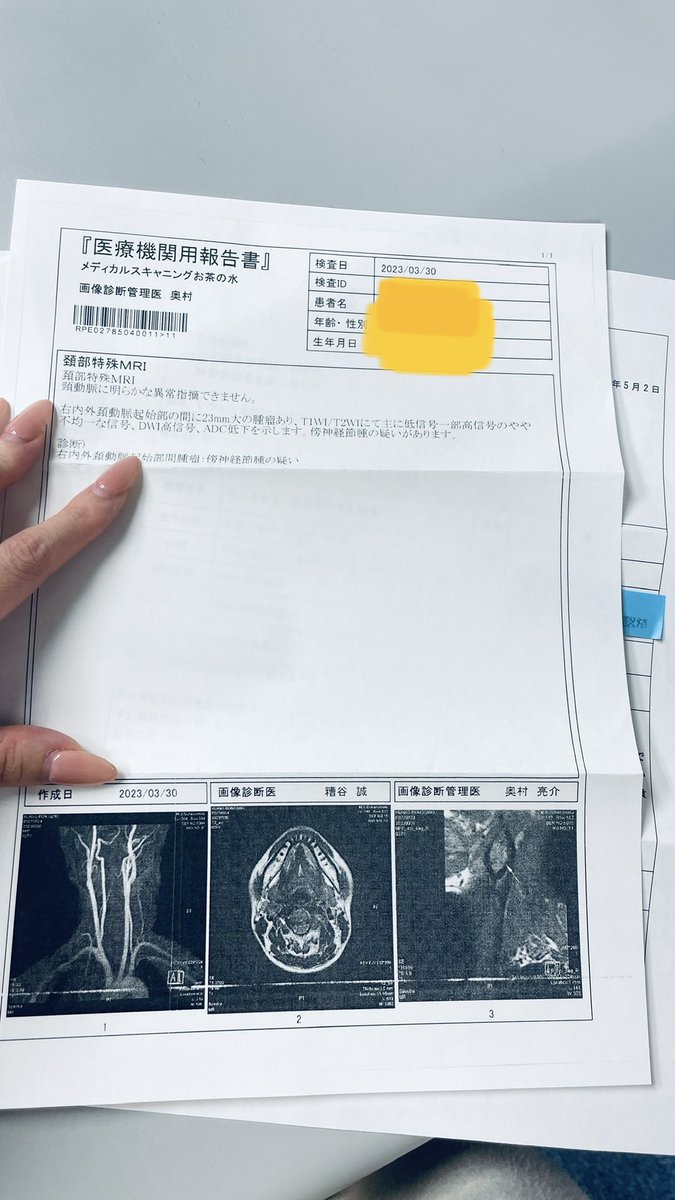 这一条推文，喵喵想要得到大家的帮助，虽然我不知道谁可以帮我
喵喵生病了，在颈动脉与颈动脉之间，有一个肿瘤，3月份的时候23mm
这个肿瘤的日文名字叫做傍神経節腫，中文名字叫做副神经节瘤/嗜铬细胞瘤
這類腫瘤很少見年發生率大約每百萬人口2-8例
