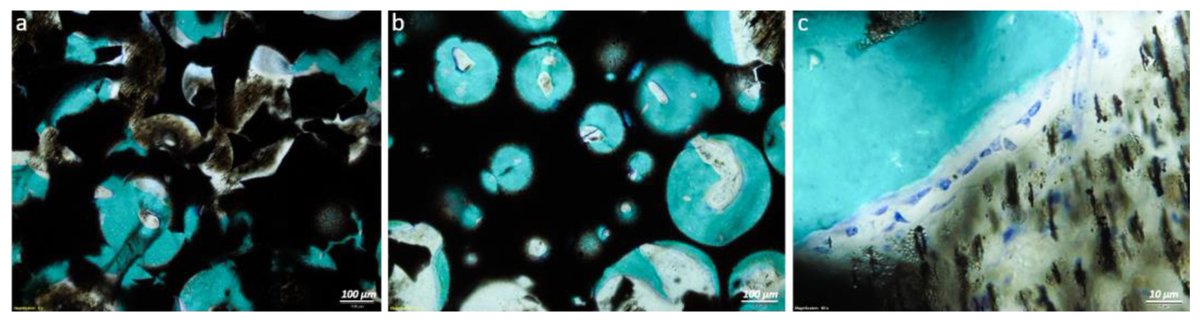 IJMS_MDPI's tweet image. #MostViewedArticles (Q1 2023)
#BoneRegeneration Guided by a Magnetized Scaffold in an #Ovine Defect Model
By: Maria Sartori et al.
More info at: mdpi.com/1422-0067/24/1…