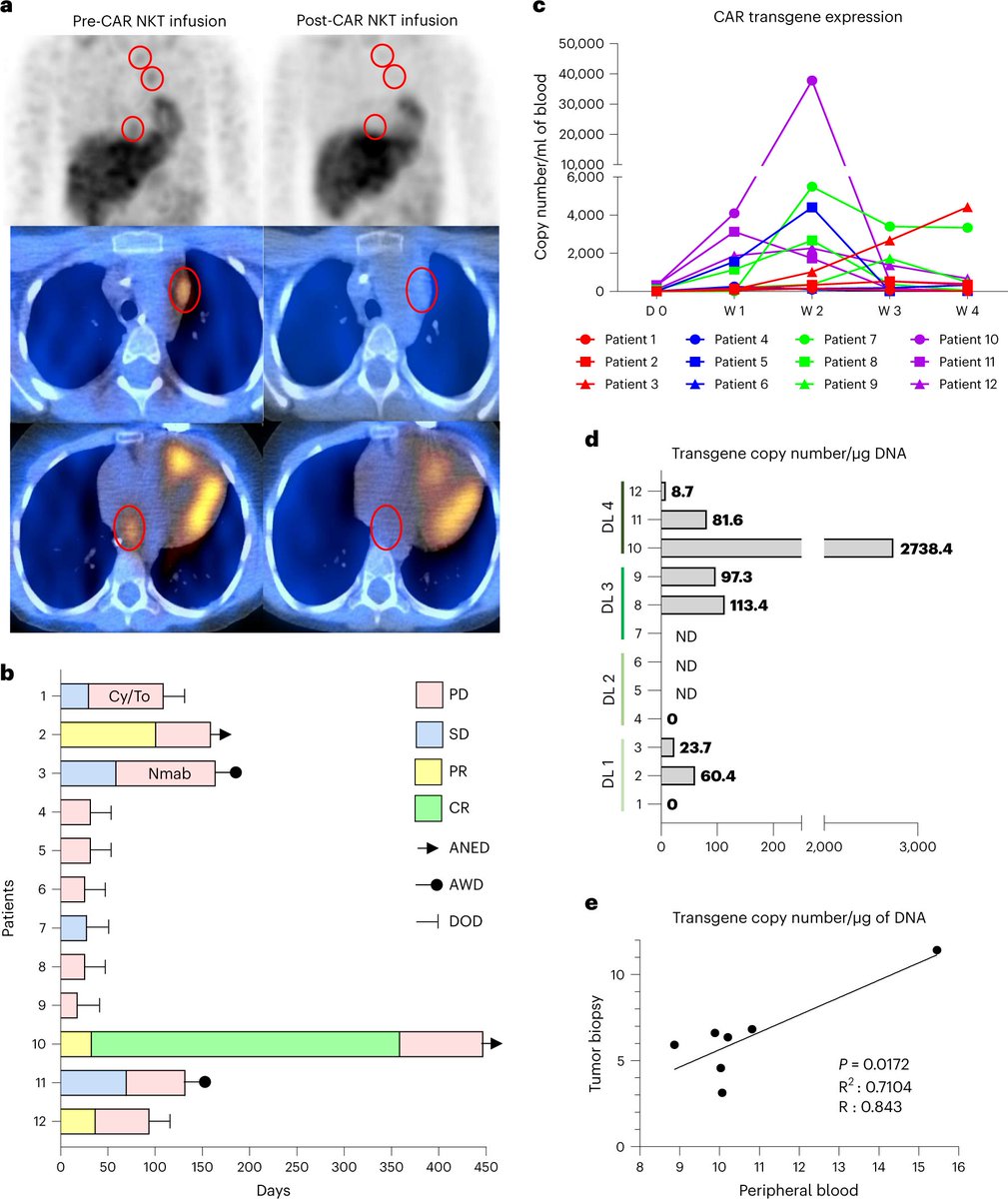 In updated phase 1 trial interim results of GD2-specific #CAR-NKT cells in patients w/ #Neuroblastoma, no dose-limiting toxicities were observed; the MTD was not reached; &amp; there was evidence of anti-tumor activity. nature.com/articles/s4159…  <a href="/HeczeyLab/">Heczey Lab</a> <a href="/BCMFromtheLabs/">From the Labs at Baylor College of Medicine</a>