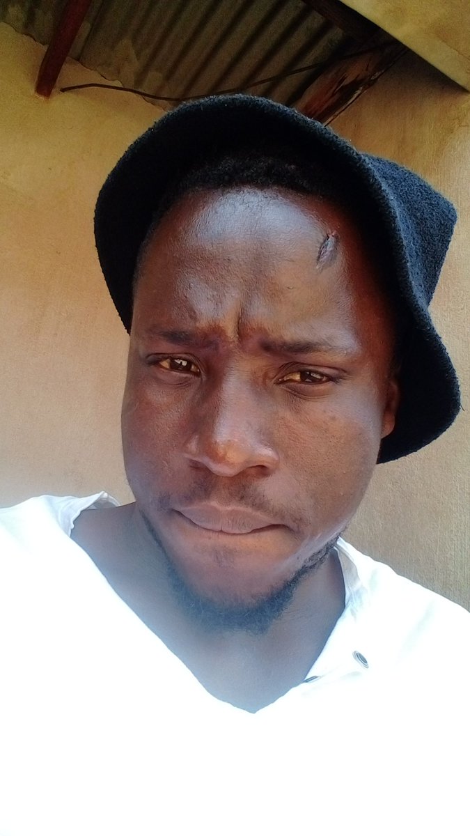 LebepeKoena's tweet photo. Ouch😎 https://t.co/XZw20uv8DN