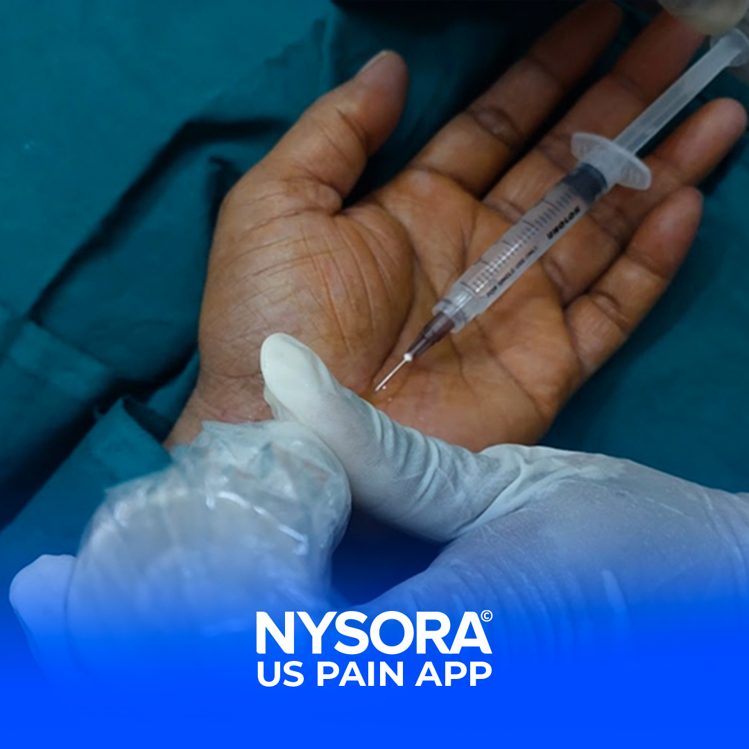 NYSORA's tweet photo. A 56-year-old male chef presented with 2 years history of right #wrist pain along with severe pain of the #radial 3 and a half fingers, increasing at night.
We just released this full case study to NYSORA's #USPain app. Download it today: https://t.co/NgursfkCH6 https://t.co/YN9knBTsWn