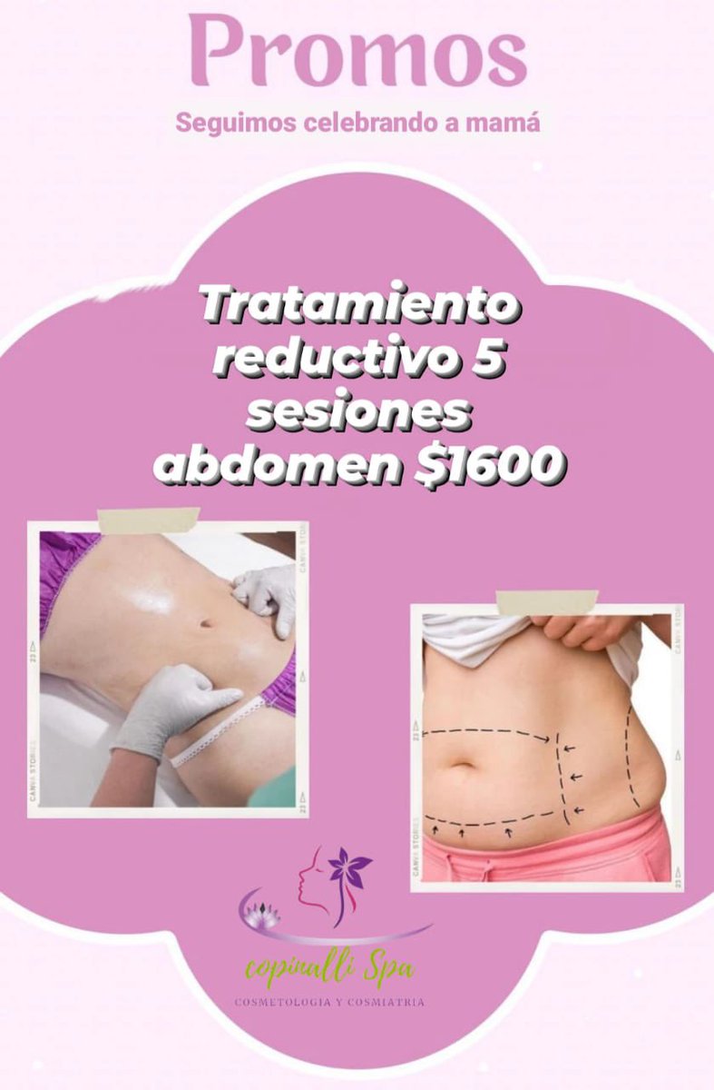 HChNoticias's tweet photo. 👋🏼 Date ese respiro de #Revitalización #Consientete 💆🏻♀️💆🏻💆🏻♂️
✅ Y aprovecha estás muy buenas #Promociones de ♨️Copinalli Spa Chignahuapan
📲7971061039
📍5ª calle de Guillermo Prieto esq con Justo Sierra #Chignahuapan https://t.co/0RJjXtOxTg