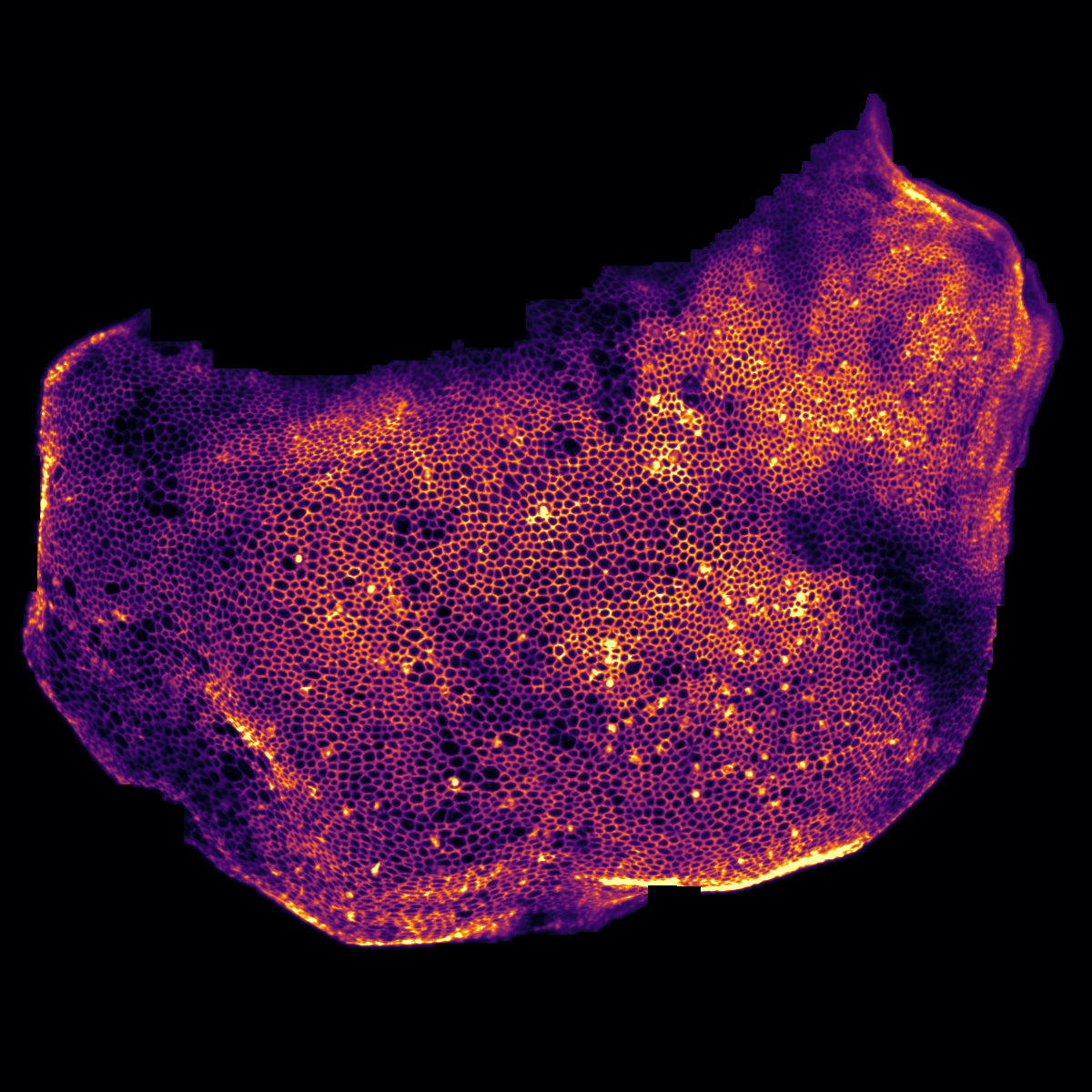 institutpasteur's tweet image. 🏥 Création d’un Institut Hospitalo-Universitaire destiné à mieux détecter et prendre en charge les troubles de l’audition et de la parole ↘️  pasteur.fr/fr/espace-pres…