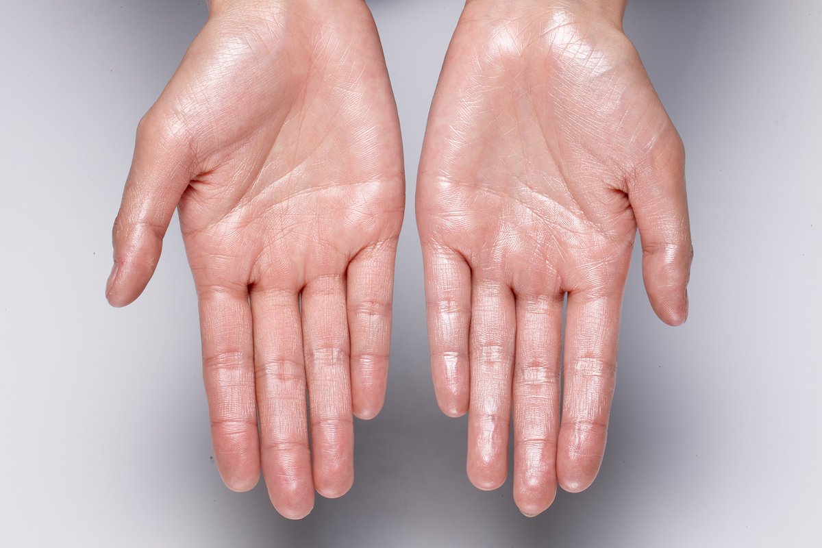 dermareading tweet picture
