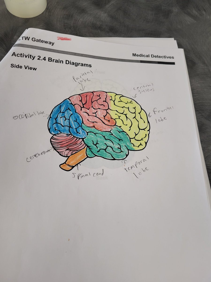 STEAM_teacher's tweet image. Our 8th graders are enjoying their end of the year project...sheep brain dissections!  @WAPerryMS @PLTWorg #funandengaging