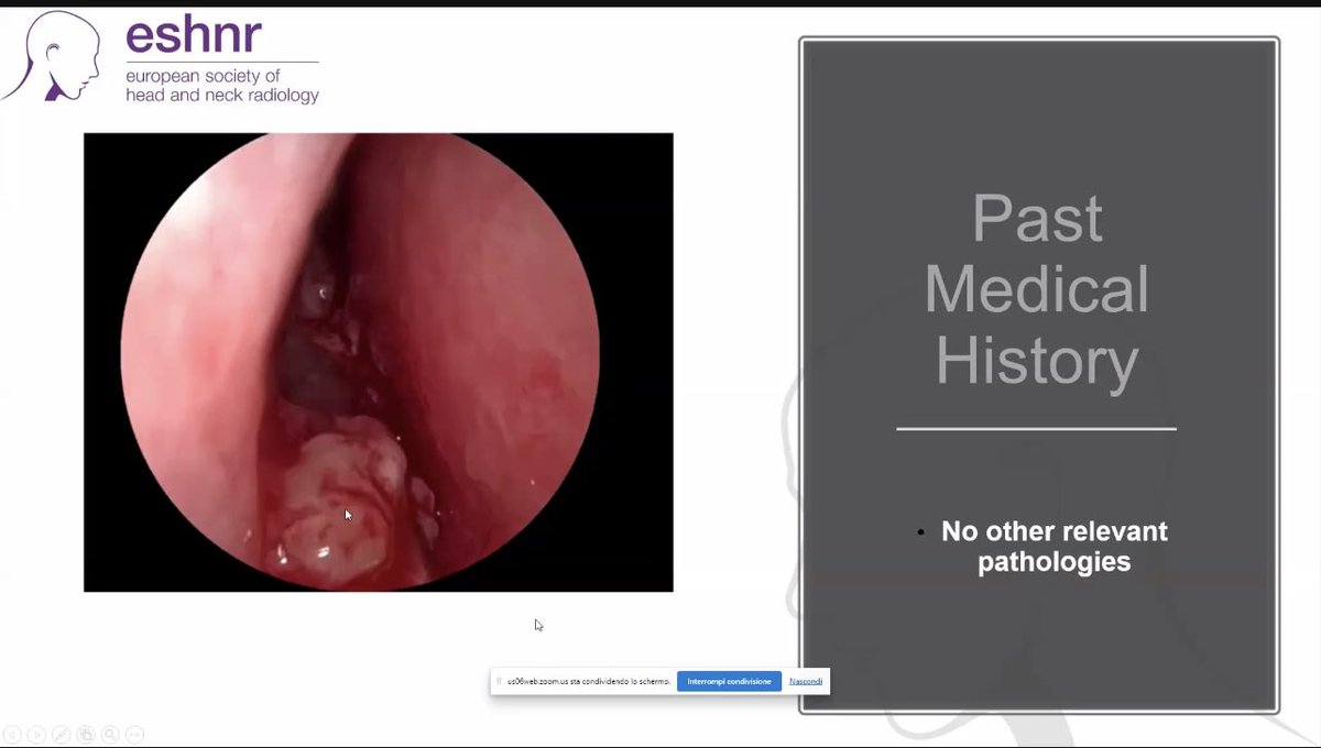 Tonight’s case webinar begins with @davidefarinabs moderated by Dr Eggesbo #hnrad @ASHNRSociety