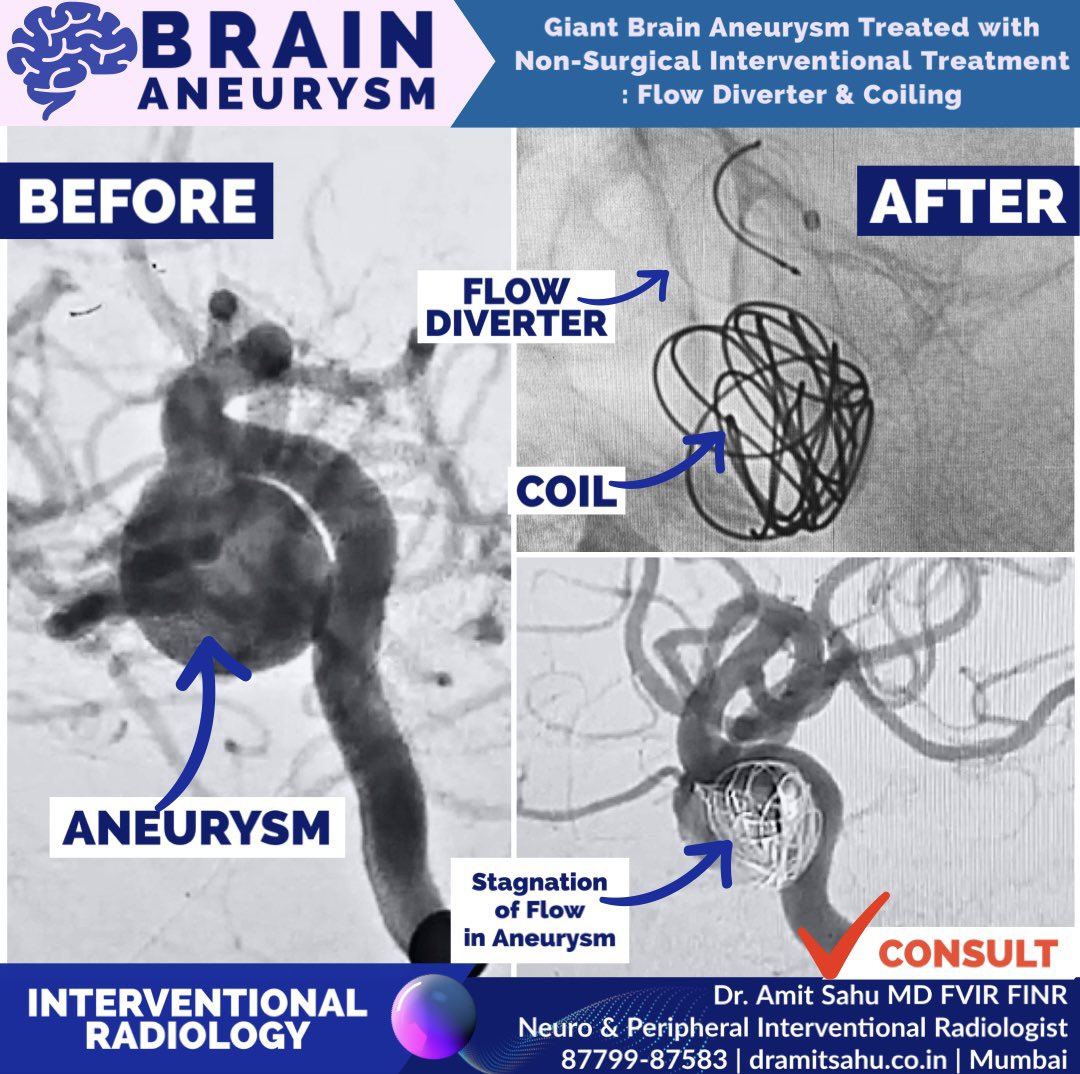 Dr. Amit Sahu MD FVIR FINR tweet media