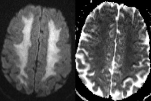 Daniel Gewolb, MD tweet media