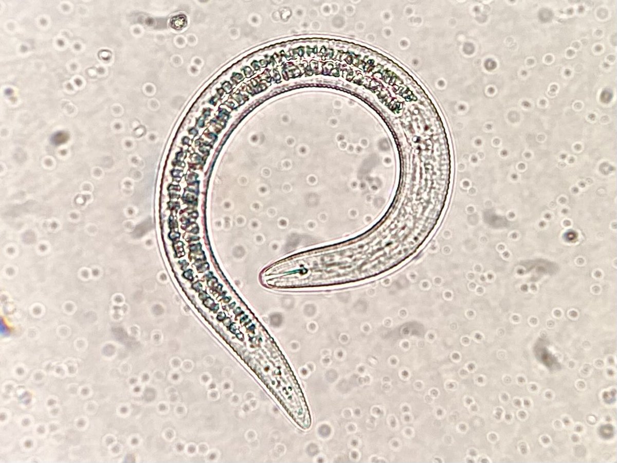 Improved weather conditions for warm season grasses has translated to more nematode samples here in SC.  Got to see one we do not typically see here in the lab, but can be problematic on turf.  Tylenchorhynchus species also known as stunt nematode.  #Nematuesday