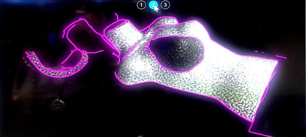 AnatgeSBRT's tweet photo. Thanks @VisionRTLtd for giving us the opportunity to test bolus #eXaSkin on #SGRT!! 

eXaSkin works great on the system and provides a great contrast on SGRT images in comparison to usual silicone bolus!

#ESTRO23 https://t.co/RjzcUUxLPZ