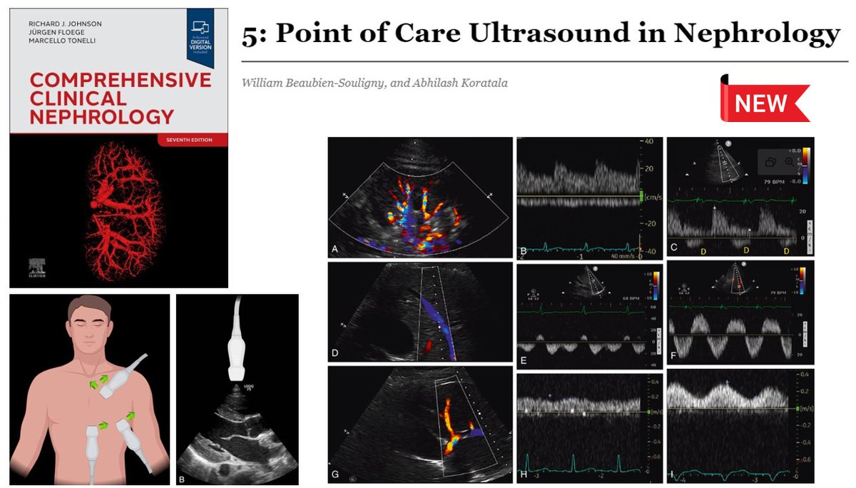 Multi-organ #POCUS is an integral component of clinical NEPHROLOGY!
Honored to write this chapter in collaboration with master @WBeaubien in <a href="/ElsevierConnect/">Elsevier</a> textbook, Comprehensive Clinical Nephrology 7th ed.
Thanks to Drs. Tonelli &amp; Johnson for the invitation.
#NephTwitter