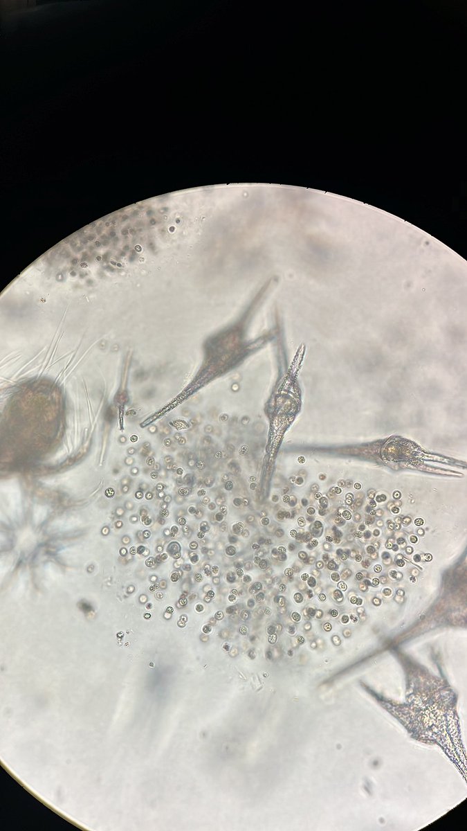 cbellissimo_'s tweet photo. Uma linda mistura de Microcystis com  Ceratium sp. 

#limnology #phycology #Microalgae https://t.co/FBS5EOeaYX