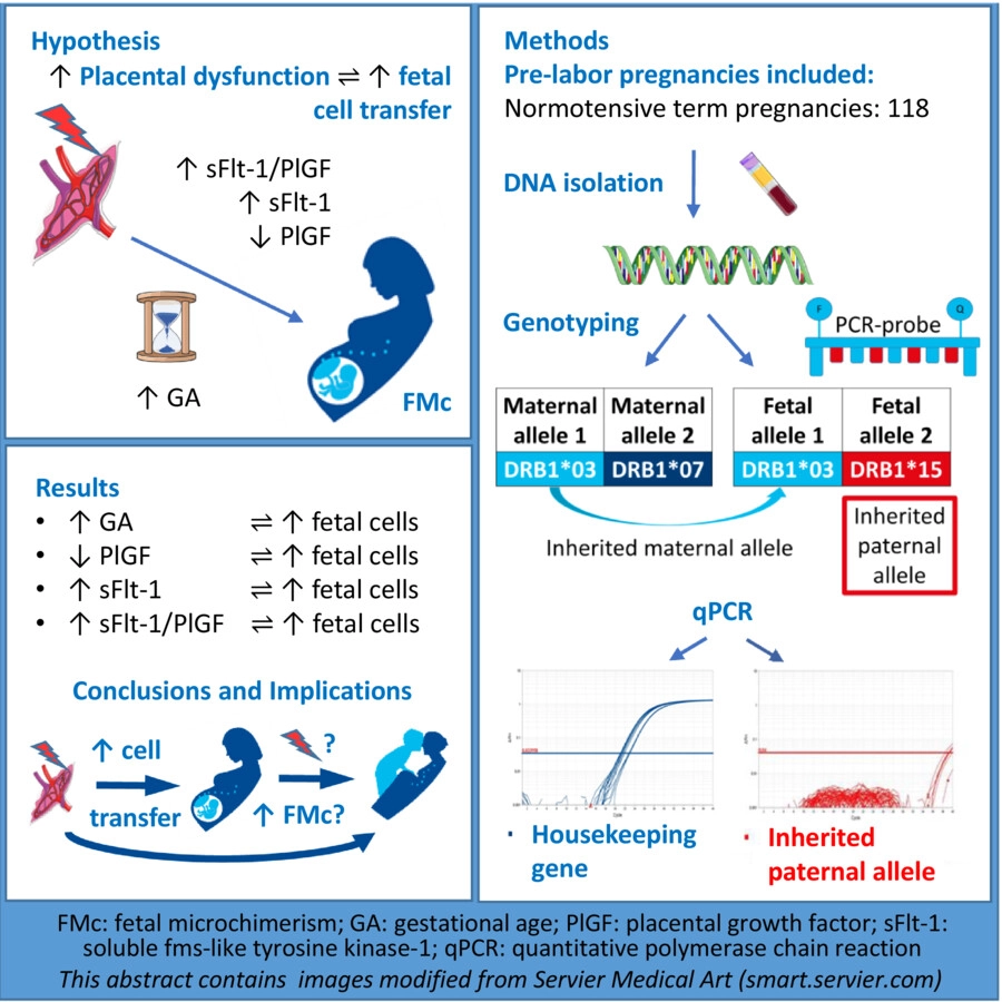 AOGS_tweets's tweet photo. Alterations in #PlGF, sFlt-1 and sFlt-1/PlGF correlate with increased nucleated fetal-origin cells in maternal circulation in normotensive term pregnancies. Underlying placental dysfunction may facilitate upregulated fetal cell transfer during #pregnancy.
https://t.co/GOIoARCE1C https://t.co/jb5Tr55r3b