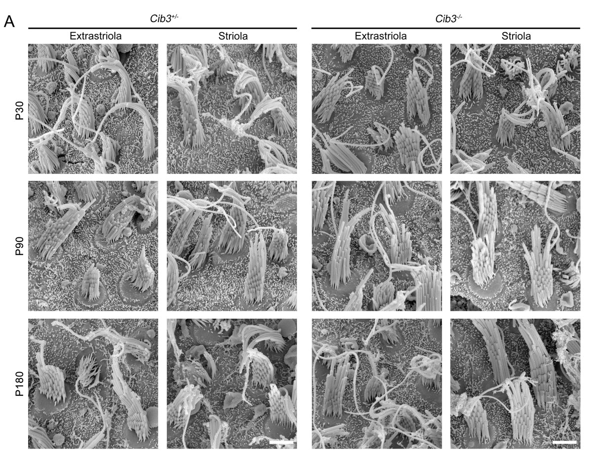 #JNeurosci: Wang, Liu et al. @Tsinghua_Uni @ShandongU @chinese_brain suggest that CIB2 and CIB3 co-regulate stereocilia maintenance as well as mechanoelectrical transduction functionality in mouse vestibular hair cells.
jneurosci.org/lookup/DOI/10.…