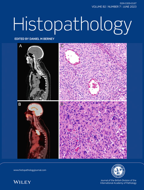 Congratulations to <a href="/JBirkness/">Jackie Birkness-Gartman</a> <a href="/JMcMahonG/">John Gross, MD</a> and colleagues for making the cover of <a href="/Histo_Journal/">Histopathology</a>! 

onlinelibrary.wiley.com/doi/10.1111/hi…