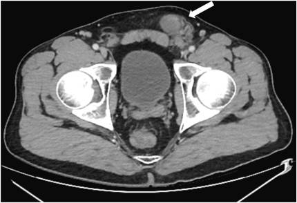 Urology Case Reports tweet media
