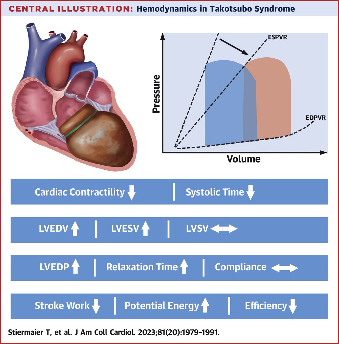 What cardiac hemodynamic abnormalities occur during the acute phase of takotsubo syndrome? Get the answer & learn more in #JACC: bit.ly/3pKufka #HeartFailure