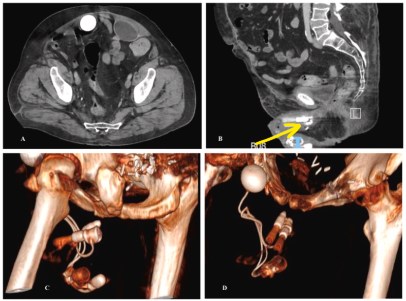 Urology Case Reports tweet media