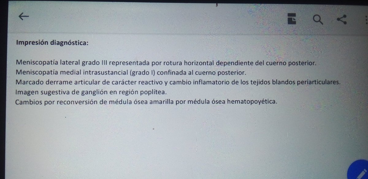 MiriamSexxx0122's tweet photo. No pues ya valió....😭
Tengo ruptura de menisco Grado lll y Grado l en mi Rodilla.
Ni #Putear podré.
A ver mañana que indicaciones me da el Traumatólogo. https://t.co/lpoYaQCXCb