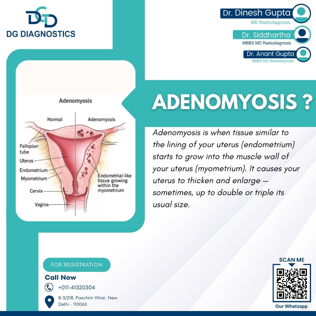 #problemoftheday  - #adenomyosis
@dgdiagnostics  - do visit for any query, best #diagnostics #centre in #paschimvihar #Delhi 
#wednesdaythought #worldhypertensionday2023