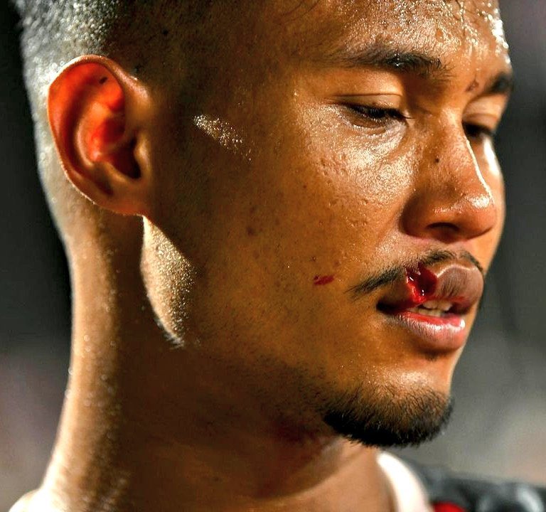 FaktaSepakbola's tweet photo. TW/BLOOD 🩸⚠️

Tweet Apresiasi kepada Bagas Kaffa, bermain full 120 menit di final dan sempat berdarah di bagian bibir.

Bagas Kaffa mendapat sikutan dari pemain Thailand, Anan Yodsangawal. Namun setelah mendapat perawatan Bagas Kaffa tetap melanjutkan hingga peluit panjang berbunyi dan membantu Timnas Indonesia meraih Medali Emas setelah 32 tahun lamanya. A True Warrior!⚔️🇮🇩🥇

What a player @bagaskaffa2!🧱