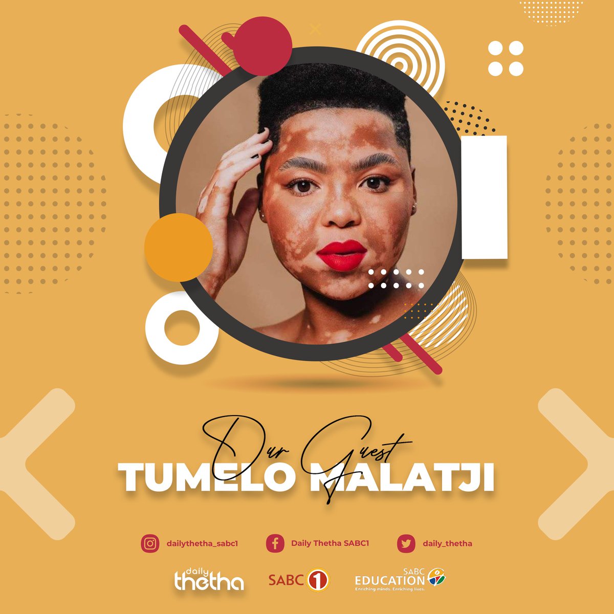 Today, we speak to people living with Vitiligo to find out how it affects their everyday experience.

We'll also speak to an expert to look into treatment options available while dispelling myths about vitiligo.

We're live at 10:30 <a href="/Official_SABC1/">SABC 1</a>. #DailyThetha
