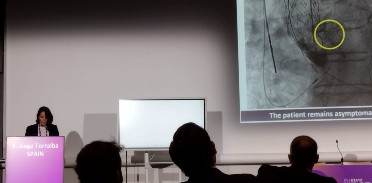 Intervencionismo Huelva HUJRJ (@ihujrj) on Twitter photo Science continues!! So proud of #Juanrateam at #euroPCR2023 we continue with another interesting case of cardiogenic shock after TAVI implantation by <a href="/ElenaIzaga/">Izaga</a> <a href="/AntonioGomezM21/">Antonio Gomez Menchero</a> <a href="/Albabfc/">Alba Abril Molina</a> <a href="/CamachoFreire/">Santiago Jesús Camacho Freire</a> <a href="/JRGhuelva/">JRG</a> <a href="/Montyks3/">Miguel Ángel Montilla</a> <a href="/OscarLa81605851/">Oscar Lagos</a> Science continues!! So proud of #Juanrateam at #euroPCR2023 we continue with another interesting case of cardiogenic shock after TAVI implantation by <a href="/ElenaIzaga/">Izaga</a> <a href="/AntonioGomezM21/">Antonio Gomez Menchero</a> <a href="/Albabfc/">Alba Abril Molina</a> <a href="/CamachoFreire/">Santiago Jesús Camacho Freire</a> <a href="/JRGhuelva/">JRG</a> <a href="/Montyks3/">Miguel Ángel Montilla</a> <a href="/OscarLa81605851/">Oscar Lagos</a>