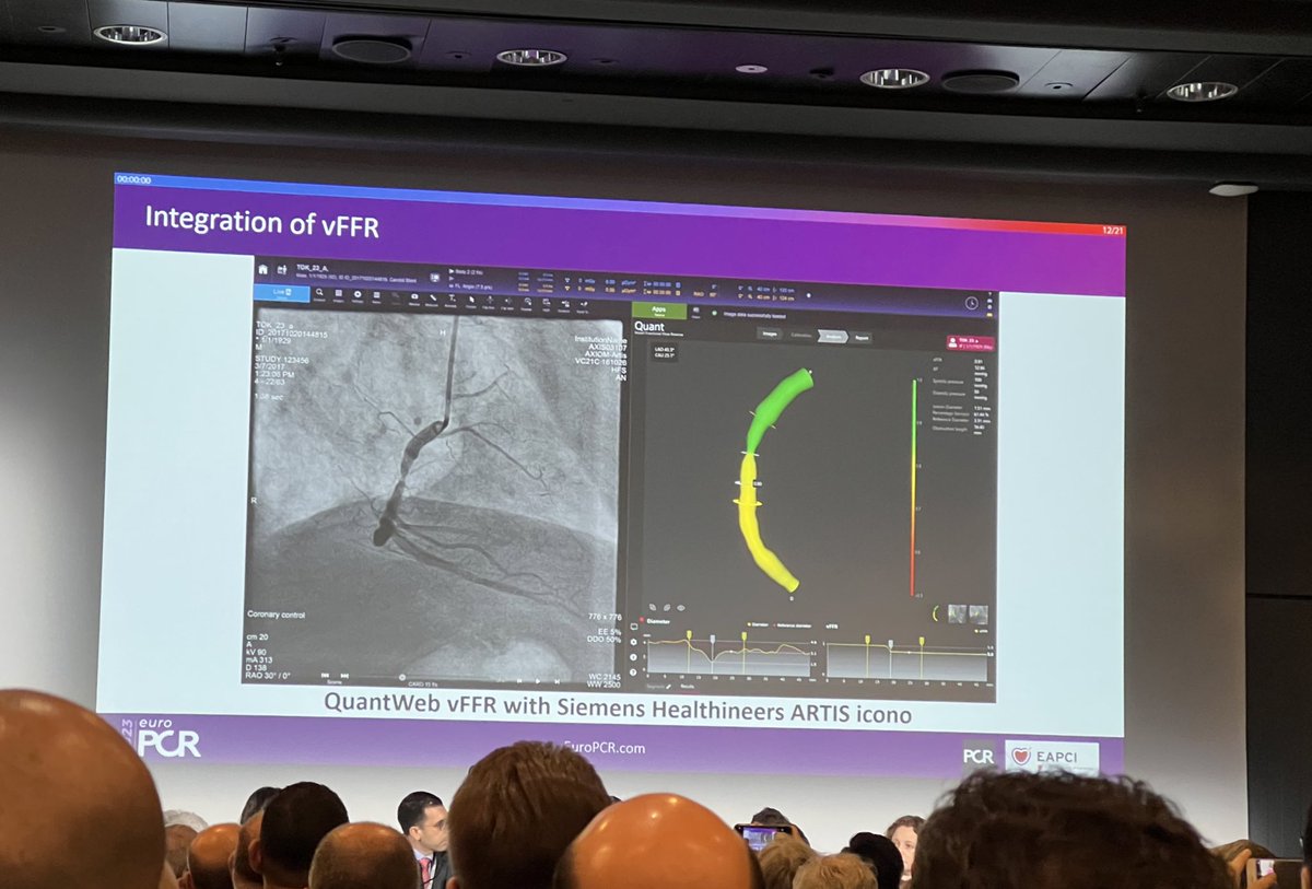 PSchlichtner's tweet photo. Angiobased #FFR from clinical evidence to daily practice.
📢now also directly integrated into the angiography system - possible in pre- and post-PCI assessment!
#EuroPCR #vFFR https://t.co/nDuBqH5tvj