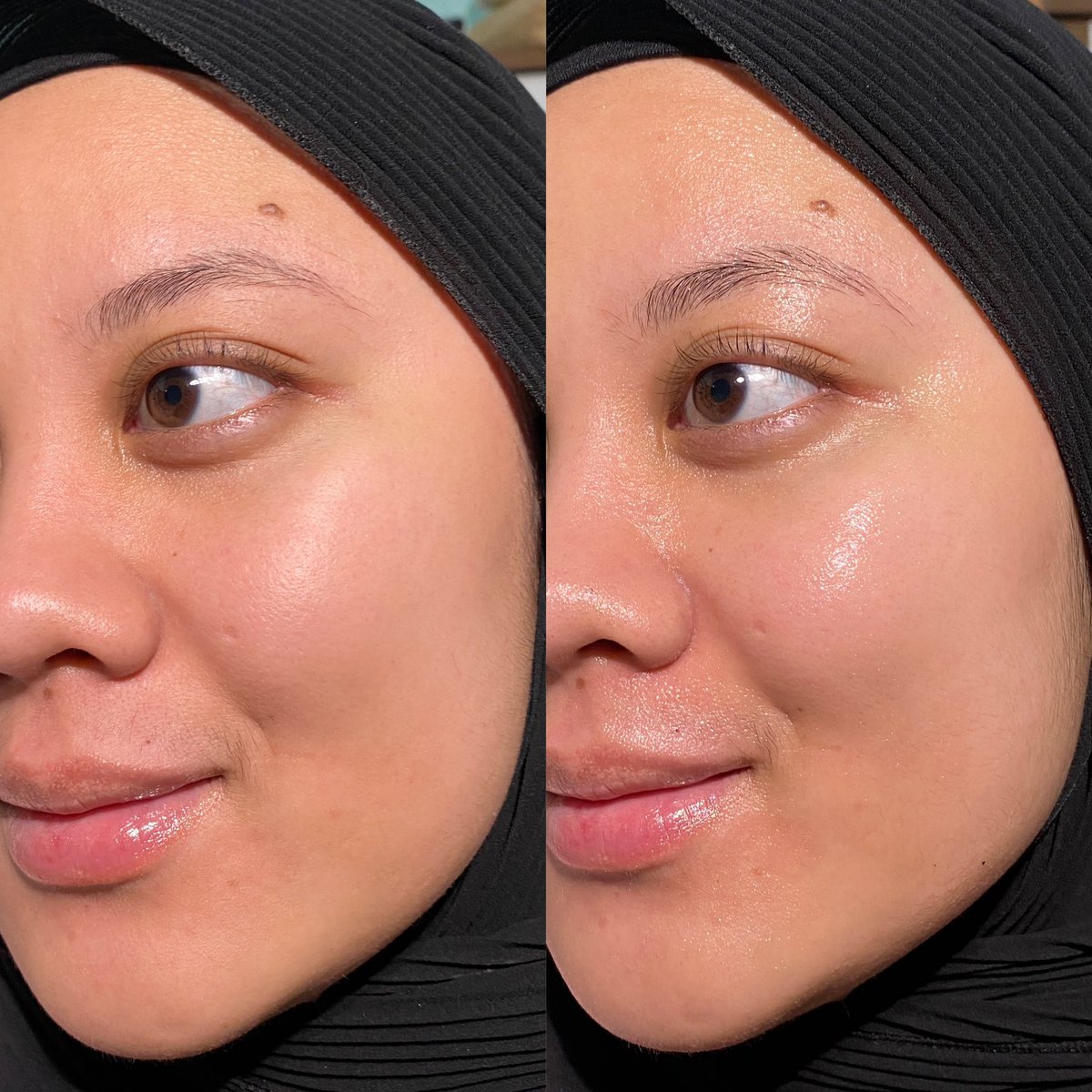 Fix cerahydro barrier moist gel punya elformula jadi moist  ter-uenakkk di 2023 sejauh inii!! Dia dipake kapanpun &amp; dalam kondisi apapun tetep oke performanya 🥹

Liatdeh ini kulitku langsung lembab + plumpy padahal pake dia doang abis double cleansing..