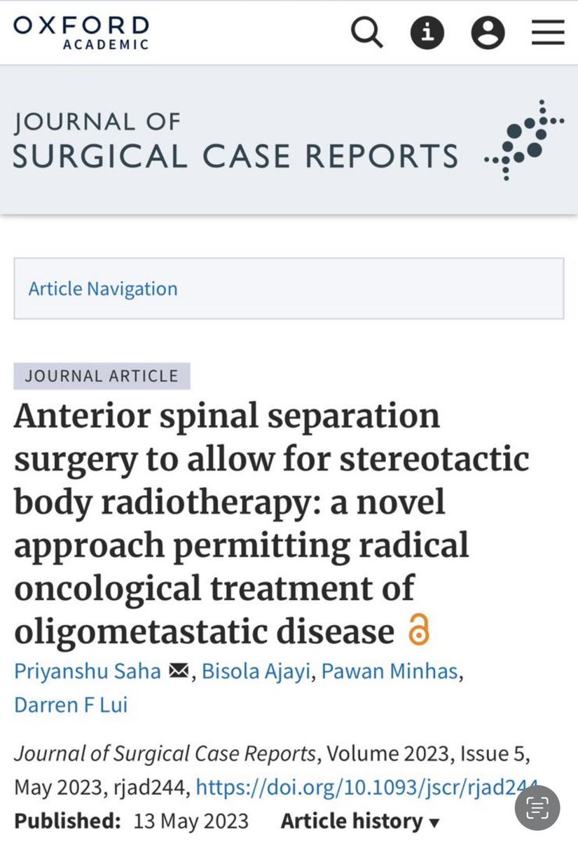 SGH Spine Research (@spineresearchsg) on Twitter photo Case Report: Illustrating a novel approach to the treatment of spinal oligometastatic disease. Read here - doi.org/10.1093/jscr/r… <a href="/JSCR_OUP/">Journal of Surgical Case Reports</a> Case Report: Illustrating a novel approach to the treatment of spinal oligometastatic disease. Read here - doi.org/10.1093/jscr/r… <a href="/JSCR_OUP/">Journal of Surgical Case Reports</a>