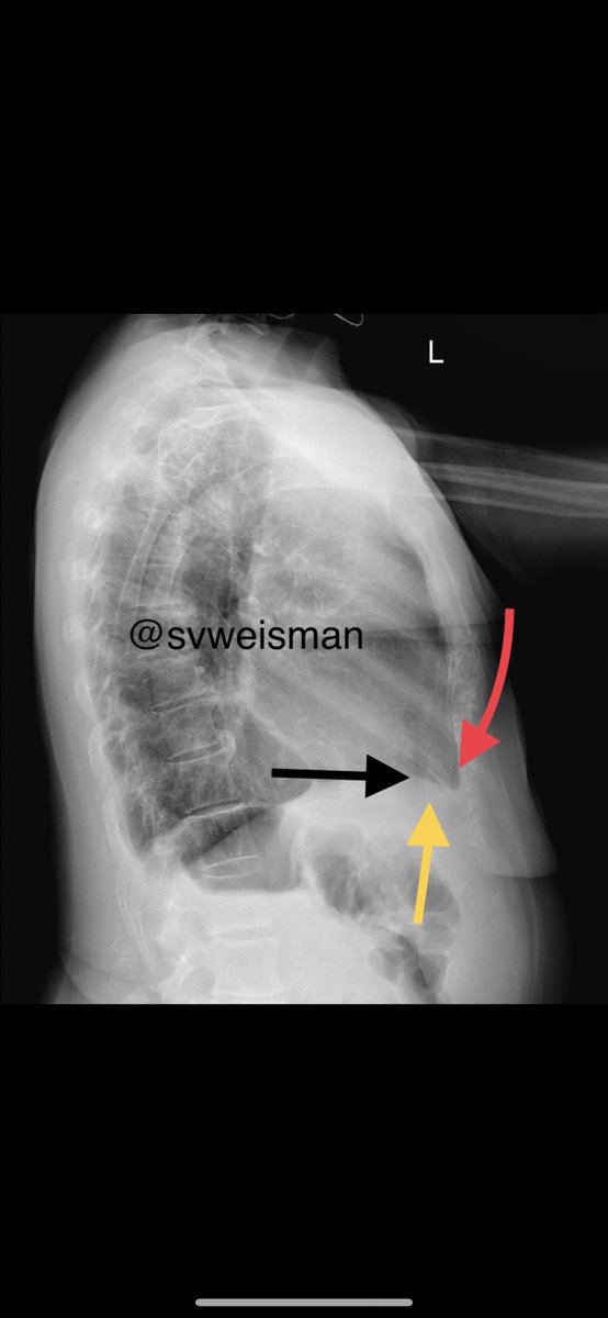 Stacey Verzosa Weisman, MD tweet media